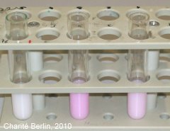 Experiment des Monats